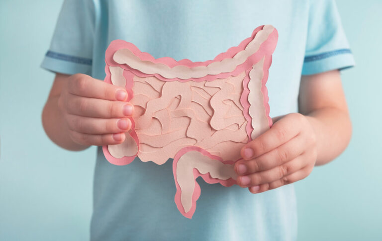 Criança segurando ilustração do intestino humano, representando saúde intestinal, microbiota intestinal desequilibrada e problemas digestivos.